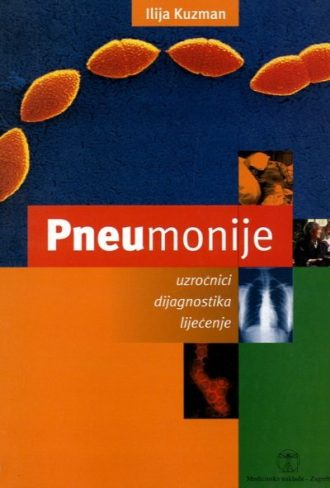 Pneumonije - uzročnici, dijagnostika, liječenje