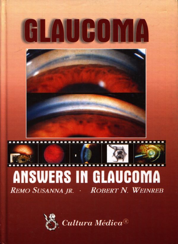 Glaucoma Remo Susanna jr, Robert N. Weinreb